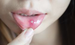 Behçet hastalığı nedir? Belirtileri nelerdir?