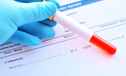 Ferritin nedir? Düşüklüğü, yüksekliği ve tedavi yöntemleri