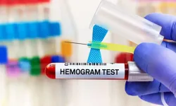 Hemogram nedir? Hemogram yüksek çıkarsa ne olur?