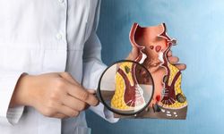Hemoroid nedir? Belirtileri, önlenmesi ve tedavisi hakkında bilmeniz gerekenler
