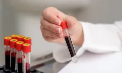 Sedimantasyon nedir? Sedimantasyon neden olur?