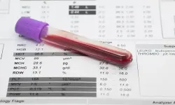 Kan tahlilindeki MCHC değeri nedir?