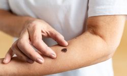Lezyon nedir? Lezyona ne sebep olur?