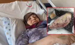 Köpek saldırısı yine can alıyordu!