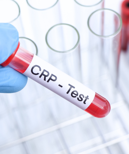 CRP nedir? Yüksekliği ne anlama gelir, tehlikeli midir?