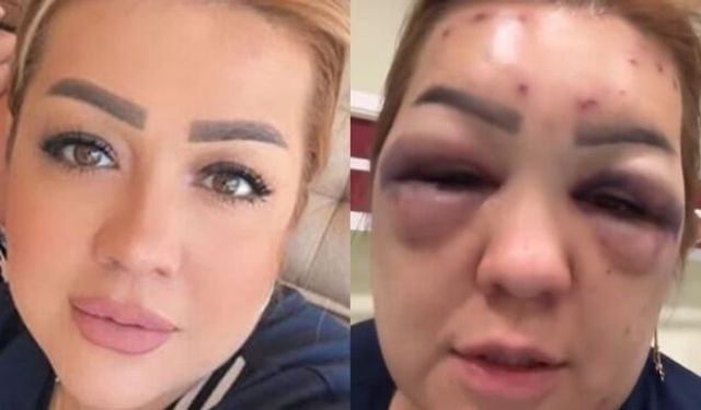 Dayak yemedi, yüzünü bu hale getiren bakın neydi!