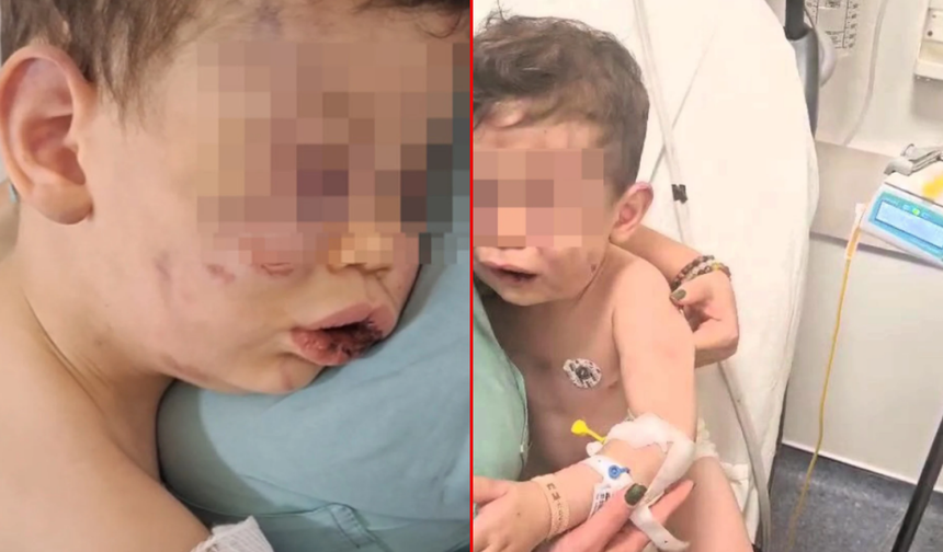 Denizli'de kan donduran olay! 2 yaşındaki bebek öldüresiye darbedildi