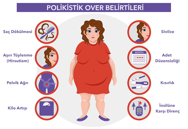 Polikistik Over Sendromu Tedavisi